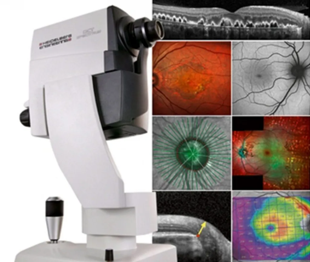 Optomap & OCT Retinal Exam Newtownards & Northern Ireland